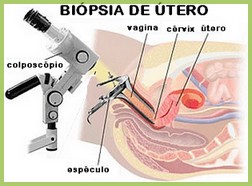 biopsia utero