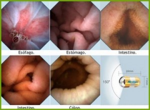 imágenes de las diferentes cavidades del tracto digestivo